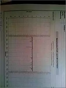 Klicken Sie auf die Grafik fr eine grere Ansicht

Name:	KW photo Form und Ra nach MF.jpg
Hits:	455
Gre:	20,9 KB
ID:	117992