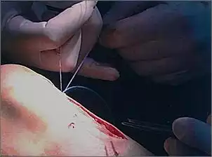 Klicken Sie auf die Grafik fr eine grere Ansicht

Name:	knie01.jpg
Hits:	197
Gre:	20,0 KB
ID:	159541