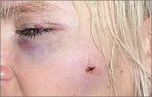 Klicken Sie auf die Grafik fr eine grere Ansicht

Name:	Jet Unfall(2).jpg
Hits:	203
Gre:	95,7 KB
ID:	292465