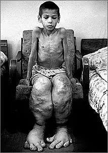 Klicken Sie auf die Grafik fr eine grere Ansicht

Name:	tschernobyl-opfer_kl.jpg
Hits:	48
Gre:	24,4 KB
ID:	694568